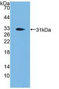 Polyclonal Antibody to Proprotein Convertase Subtilisin/Kexin Type 1 (PCSK1)