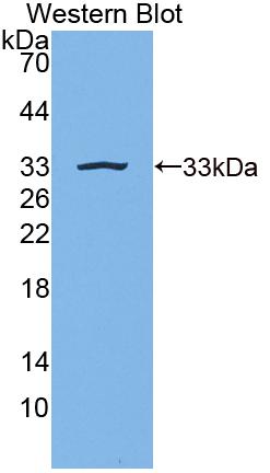 Polyclonal Antibody to Gibbon Ape Leukemia Virus Receptor 1 (GLVR1)