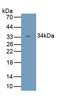Polyclonal Antibody to Uncoupling Protein 4, Mitochondrial (UCP4)