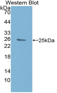Polyclonal Antibody to B-Cell CLL/Lymphoma 9 (Bcl9)