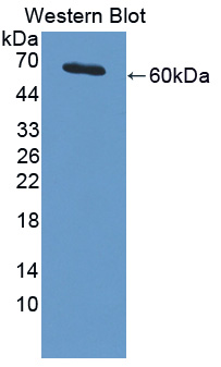 Polyclonal Antibody to Protein Inhibitor Of Activated STAT 3 (PIAS3)