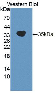 Polyclonal Antibody to Cyclin Dependent Kinase 20 (CDK20)