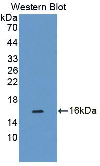 Polyclonal Antibody to Cyclin Dependent Kinase 2 Associated Protein 1 (CDK2AP1)