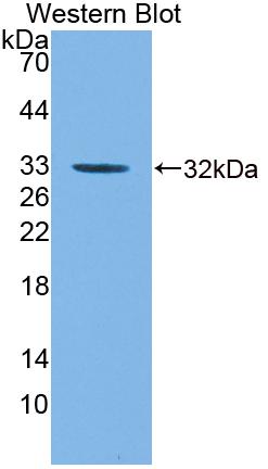 Polyclonal Antibody to Guanylate Binding Protein 5 (GBP5)