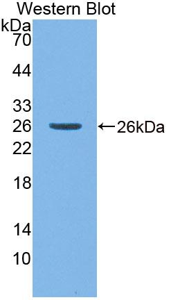 Polyclonal Antibody to Dihydropyrimidinase Like Protein 4 (DPYSL4)