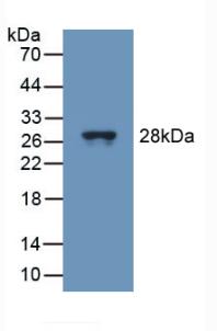 Polyclonal Antibody to Tubulin Delta (TUBd)