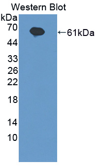 Polyclonal Antibody to Interleukin 20 Receptor Alpha (IL20Ra)