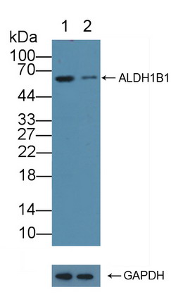 Polyclonal Antibody to Aldehyde Dehydrogenase 1 Family, Member B1 (ALDH1B1)