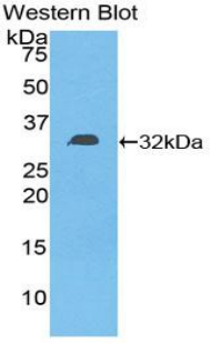 Polyclonal Antibody to Diacylglycerol Kinase Epsilon (DGKe)
