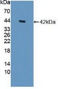 Polyclonal Antibody to Histone Deacetylase 9 (HDAC9)