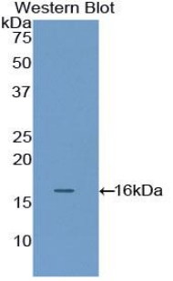 Polyclonal Antibody to Filamin B Beta (FLNb)