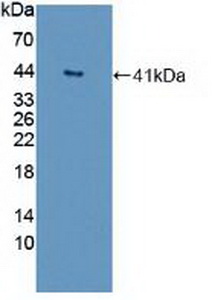 Polyclonal Antibody to G Protein Beta 2 (GNb2)