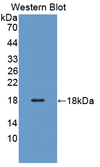Polyclonal Antibody to Profilin 3 (PFN3)