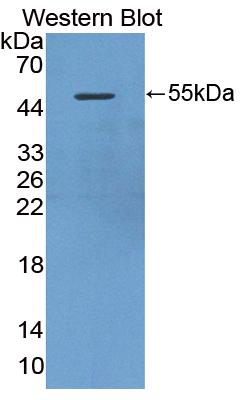 Polyclonal Antibody to Death Associated Protein Kinase 3 (DAPK3)