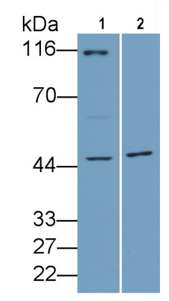 Polyclonal Antibody to Aurora Kinase A (AURKA)