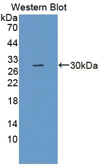 Polyclonal Antibody to Docking Protein 3 (DOK3)