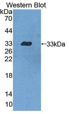Polyclonal Antibody to Dystrobrevin Beta (DTNb)