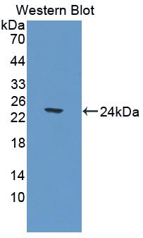Polyclonal Antibody to Carnosine Dipeptidase 1 (CNDP1)