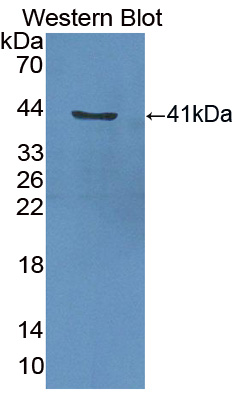 Polyclonal Antibody to Centaurin Alpha 2 (CENTa2)