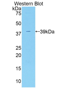 Polyclonal Antibody to Centaurin Alpha 2 (CENTa2)