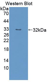 Polyclonal Antibody to Kinesin Family, Member 5B (KIF5B)