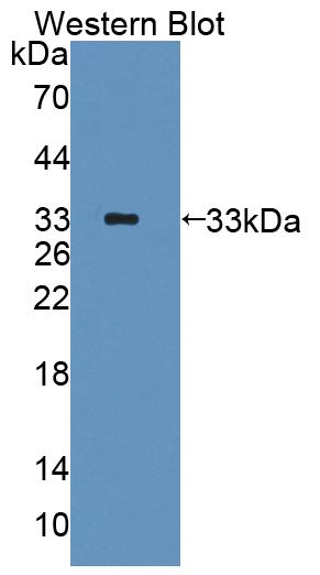 Polyclonal Antibody to Phosphodiesterase 10A (PDE10A)