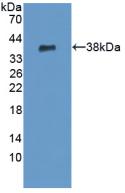 Polyclonal Antibody to Peptidyl Arginine Deiminase Type VI (PADI6)