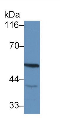 Polyclonal Antibody to Dual Specificity Phosphatase 5 (DUSP5)