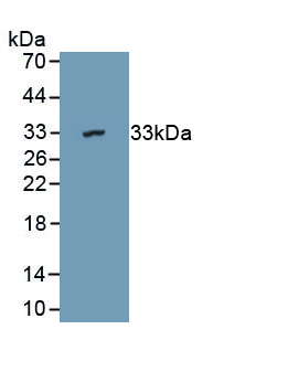 Polyclonal Antibody to Aspartyl tRNA Synthetase 2, Mitochondrial (DARS2)