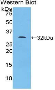 Polyclonal Antibody to Dedicator Of Cytokinesis 1 (DOCK1)