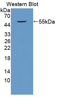 Polyclonal Antibody to ATPase, H+ Transporting, Mitochondrial F1 Complex Beta Polypeptide (ATP5b)