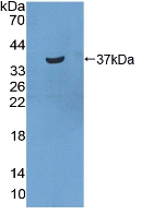 Polyclonal Antibody to Statherin (STATH)