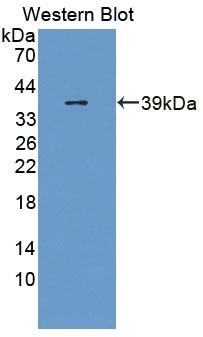 Polyclonal Antibody to Secretoglobin Family 2A, Member 2 (SCGB2A2)