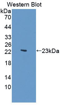 Polyclonal Antibody to Lysine Specific Demethylase 4A (KDM4A)