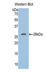 Polyclonal Antibody to Ubiquitin Carboxyl Terminal Hydrolase L3 (UCHL3)