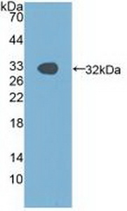 Polyclonal Antibody to p21 Protein Activated Kinase 1 (PAK1)