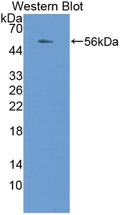 Polyclonal Antibody to NAD Kinase (NADK)