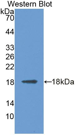 Polyclonal Antibody to Mannosidase Alpha Class 2B Member 1 (MAN2B1)