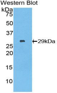 Polyclonal Antibody to Lymphocyte Adaptor Protein (Lnk)