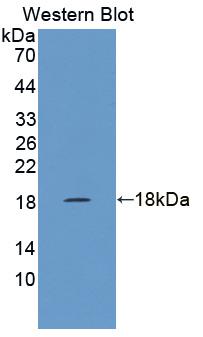 Polyclonal Antibody to Zinc Ribbon Domain Containing Protein 1 (ZNRD1)