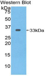 Polyclonal Antibody to Pleckstrin Homology Domain Containing Family A, Member 1 (PLEKHA1)