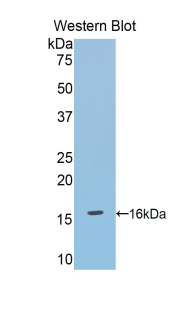 Polyclonal Antibody to Debranching Enzyme Homolog 1 (DBR1)