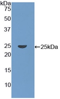 Polyclonal Antibody to Coronin 1A (CORO1A)