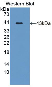 Polyclonal Antibody to LIM Domain Binding Protein 1 (LDB1)