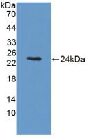 Polyclonal Antibody to Branched Chain Alpha-Ketoacid Dehydrogenase Kinase (BCKDK)