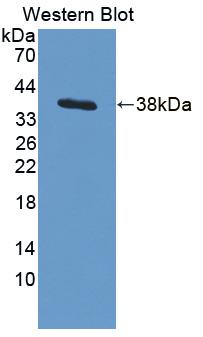 Polyclonal Antibody to Actin Related Protein 2/3 Complex Subunit 2 (ARPC2)