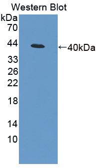 Polyclonal Antibody to Desmoyokin (AHNAK)