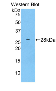 Polyclonal Antibody to A Disintegrin And Metalloprotease 15 (ADAM15)