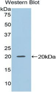Polyclonal Antibody to Non Metastatic Cells 2, Protein NM23B Expressed In (NME2)