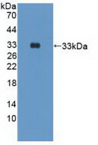 Polyclonal Antibody to Phosphoinositide-3-Kinase Catalytic Delta Polypeptide (PIK3Cd)
